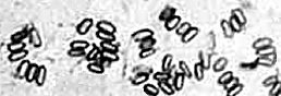 Paenibacillus larvae spores