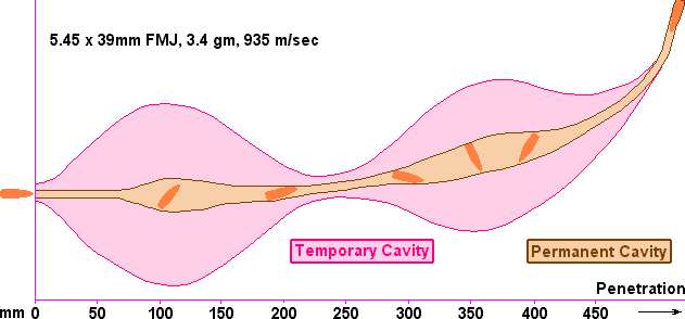 Wound channel of 5.45 x 39mm round